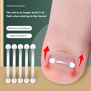 Инструменты для коррекции вросших ногтей на ногах Для педикюра Для восстановления вросших ногтей на ногах Профессиональное средство для коррекции вросших ногтей на ногах